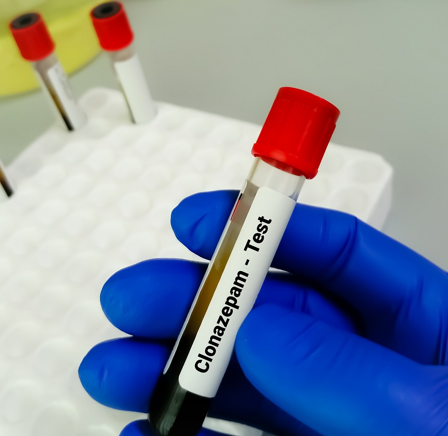 da-li-rivotril-stvara-zavisnost